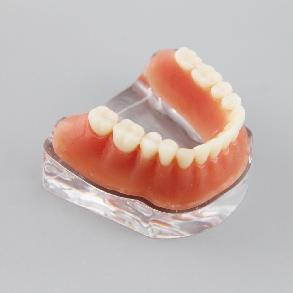 Dental Inferior Overdenture Model Lower Precision Implants With Silver Bar #6009
