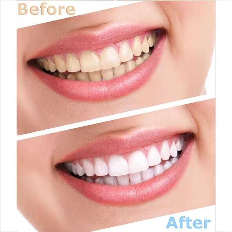 Portable Teeth Whitening Machine Bleaching Accelerator 6 LEDs Cold Light YS-TW-A