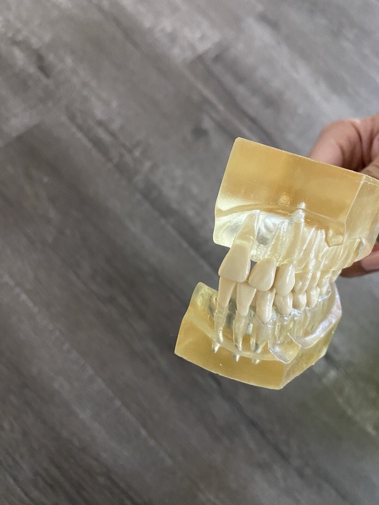 Quadrant Typodont Teeth Display