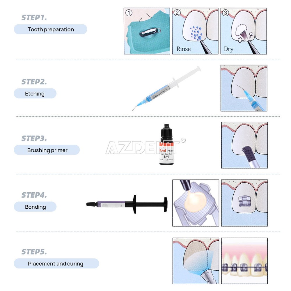 Dental Orthodontic Bracket Adhesive Bonding System Light Cure Syringe Kit