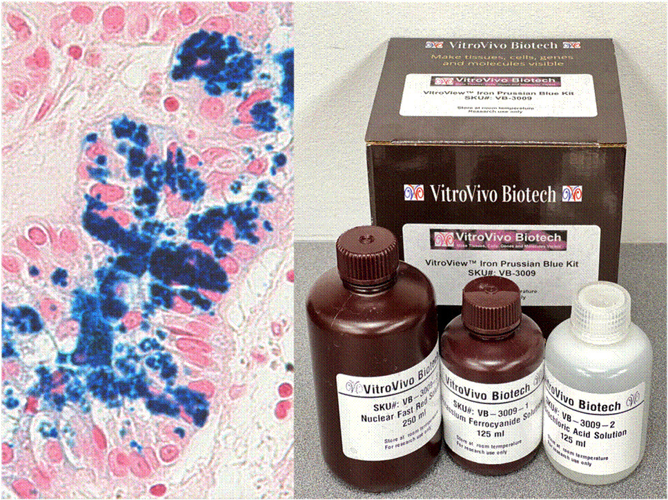 VitroView™ Prussian Blue Stain Kit (Cat# VB-3009)