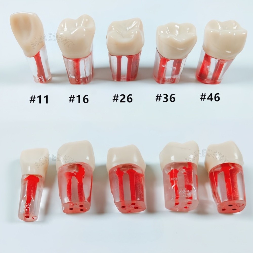 10Pcs Dental Root Canal Teeth Study Practice Model for Endodontic RCT File Molar