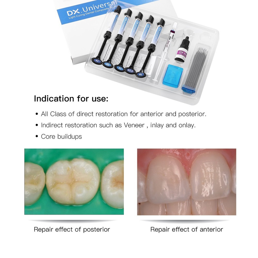 Dental Orthodontic Bonding Bracket Light Cure Adhesive Etching Gel Composite kit
