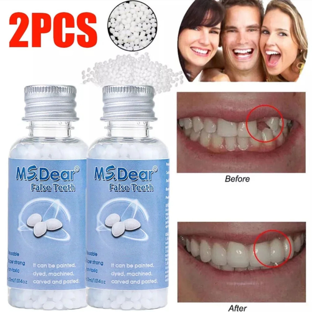 2× Resin False Teeth Solid Glue Temporary Tooth Gap Filler Tooth Repair Moldable