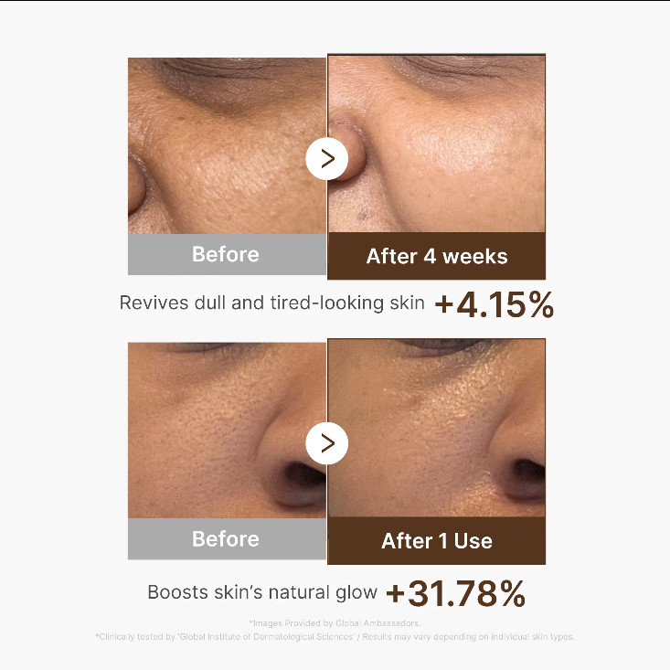 MEDICUBE_Deep Vitamin C Capsule Serum