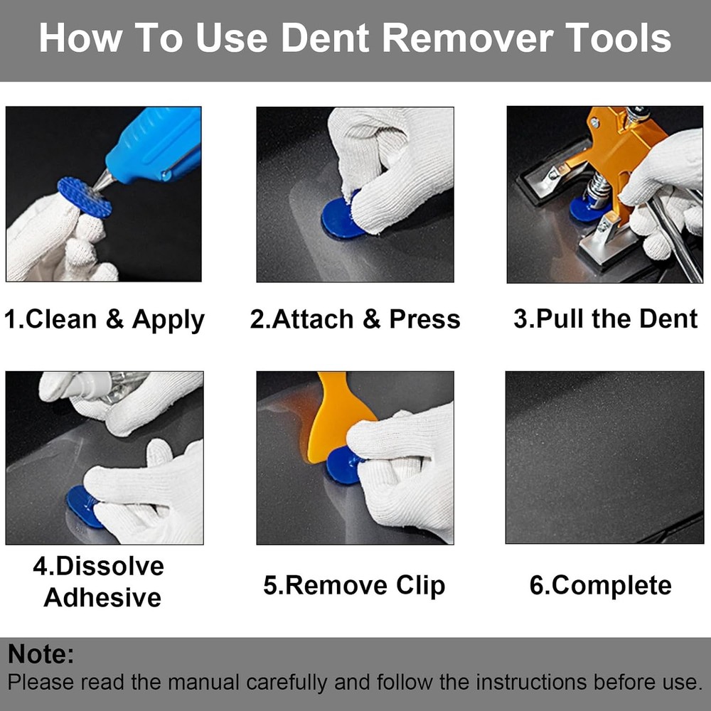 Professional Dent Removal Kit - Paint-Safe & Effective