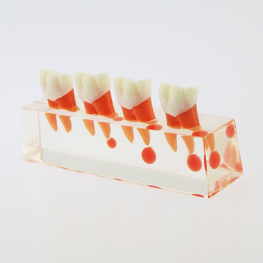 1 Pcs Dental 4 Stage Endodontic Treatment Study Teaching Typodont Teeth Model