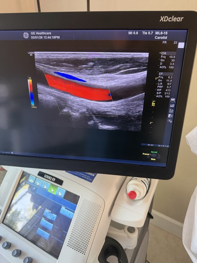 GE ML6-15 D Linear Vascular Probe , Excellent working condition,
