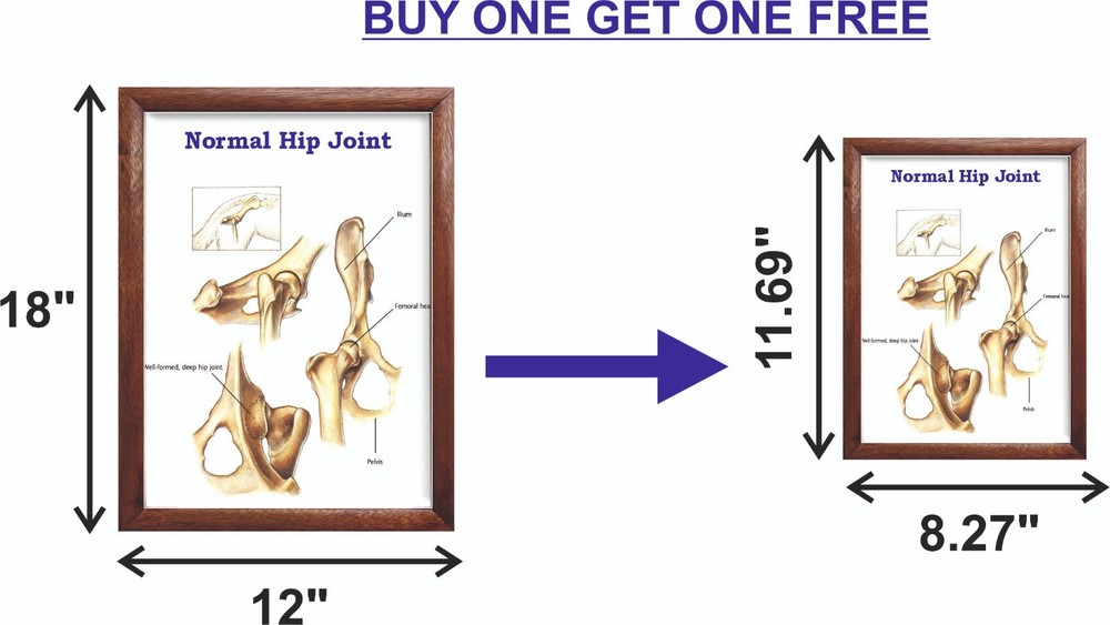 Normal Hip Joint Chart 12x18 inches
