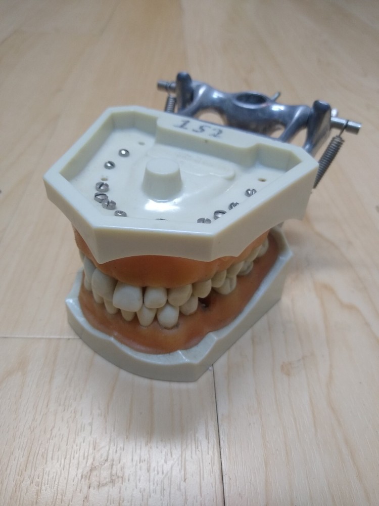 Columbia Dental Typodont Teeth Model R861 with Removable Teeth (missing 5 teeth)