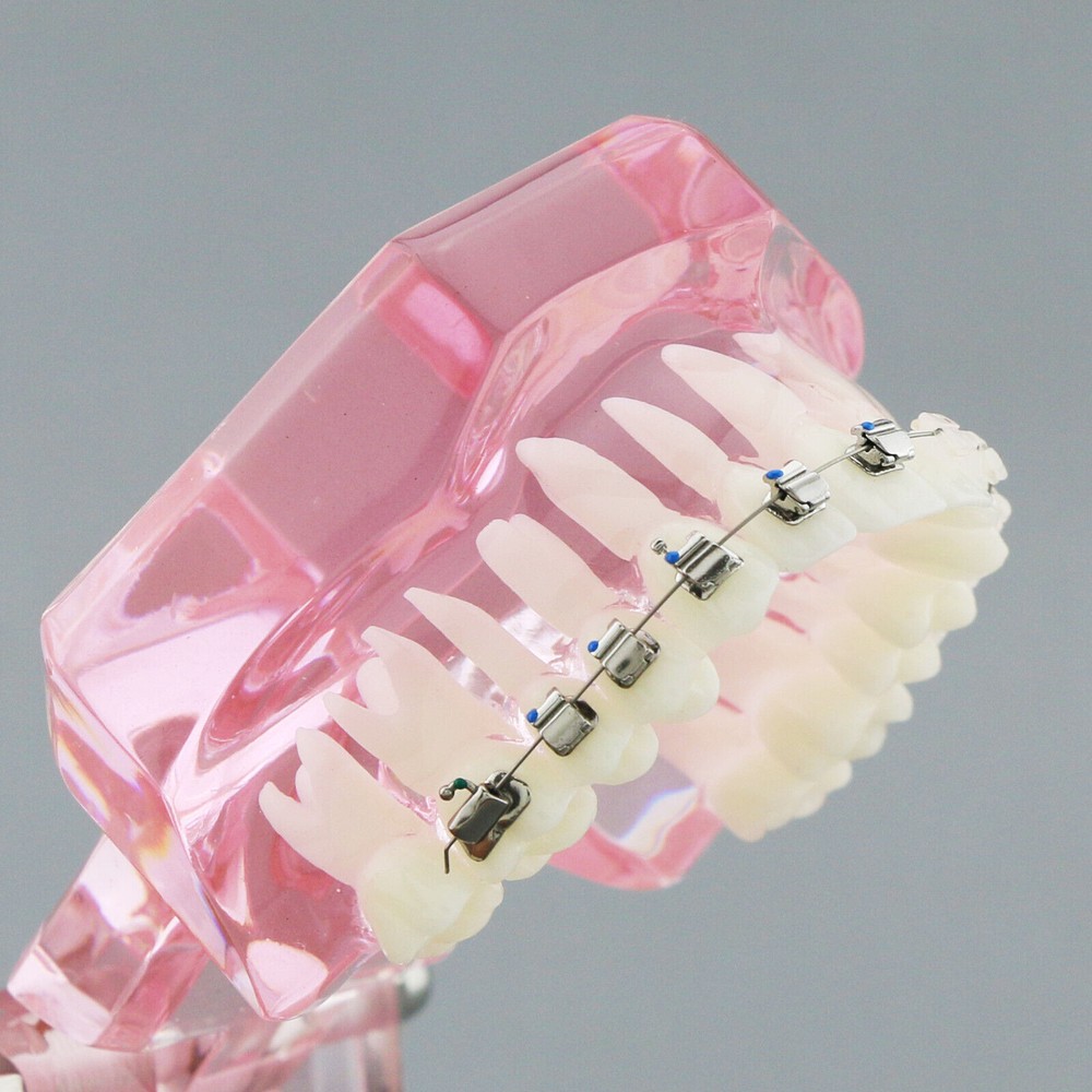 Dental Typodont Model Self-ligating Metal Bracket Ceramic Transparent Retainer