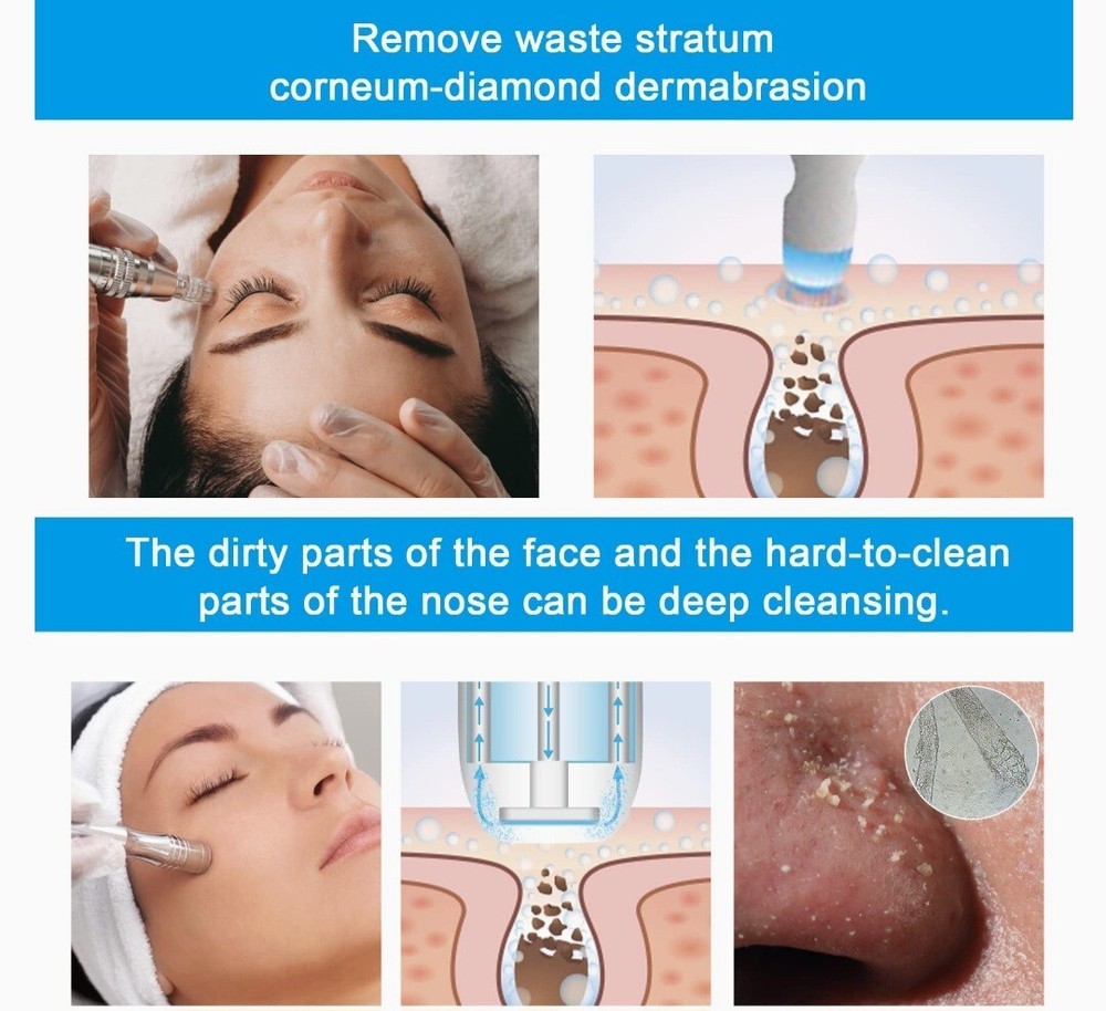 Diamond Microdermabrasion Machine Professional Dermabrasion Machine