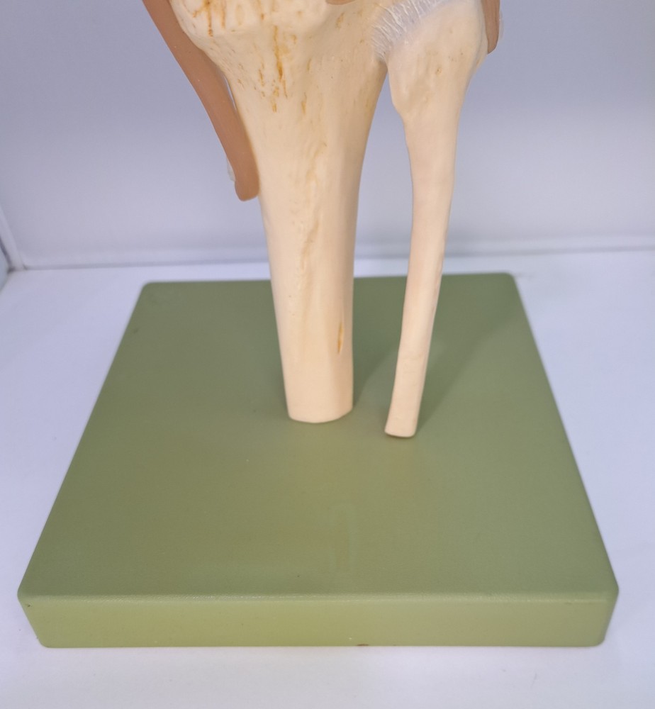 Vintage 1995 Somso Anatomical Model Functional Knee Joint Model BIN86