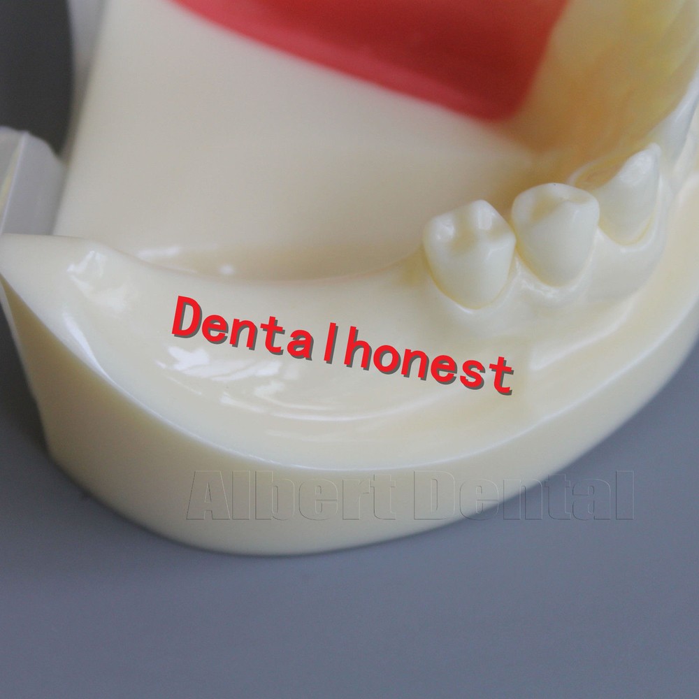 Great Dental Full Implant Drilling Practice Teeth Study Model Typodont Model