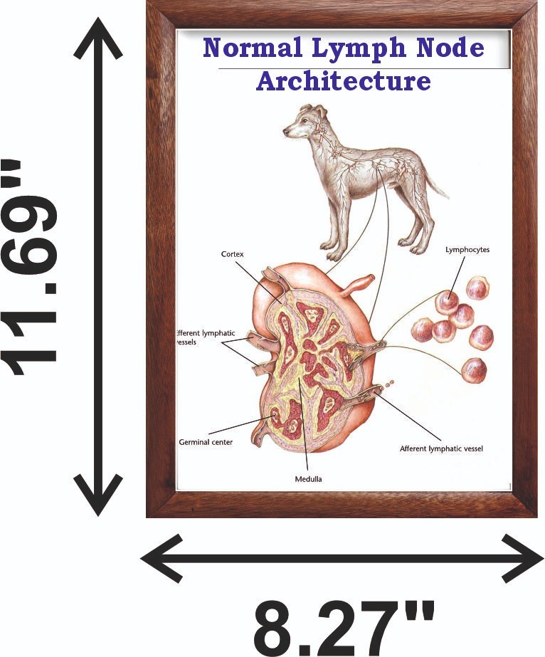 Normal Lymph Node Architecture Chart 12x18 inches