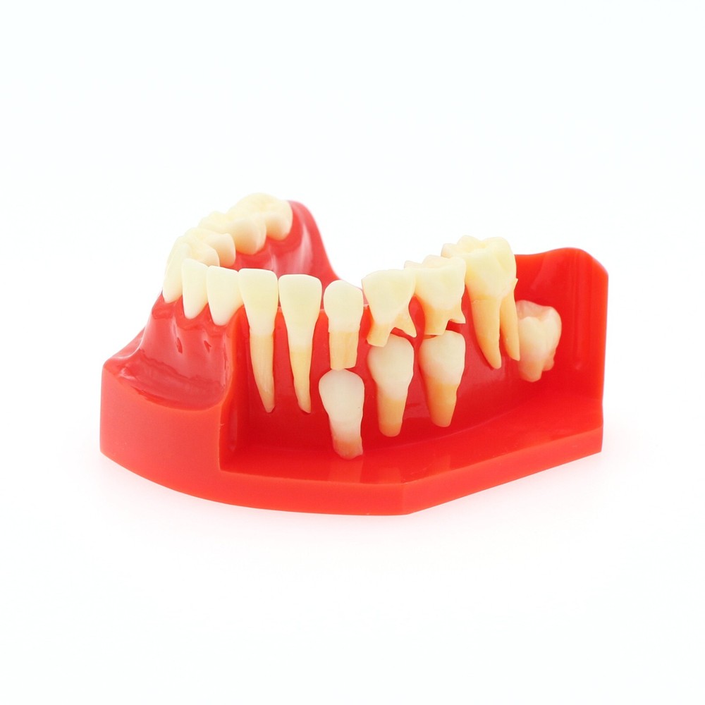 M7013 Teeth Permanent Tooth Dental Alternate Demonstration Study Teach Model