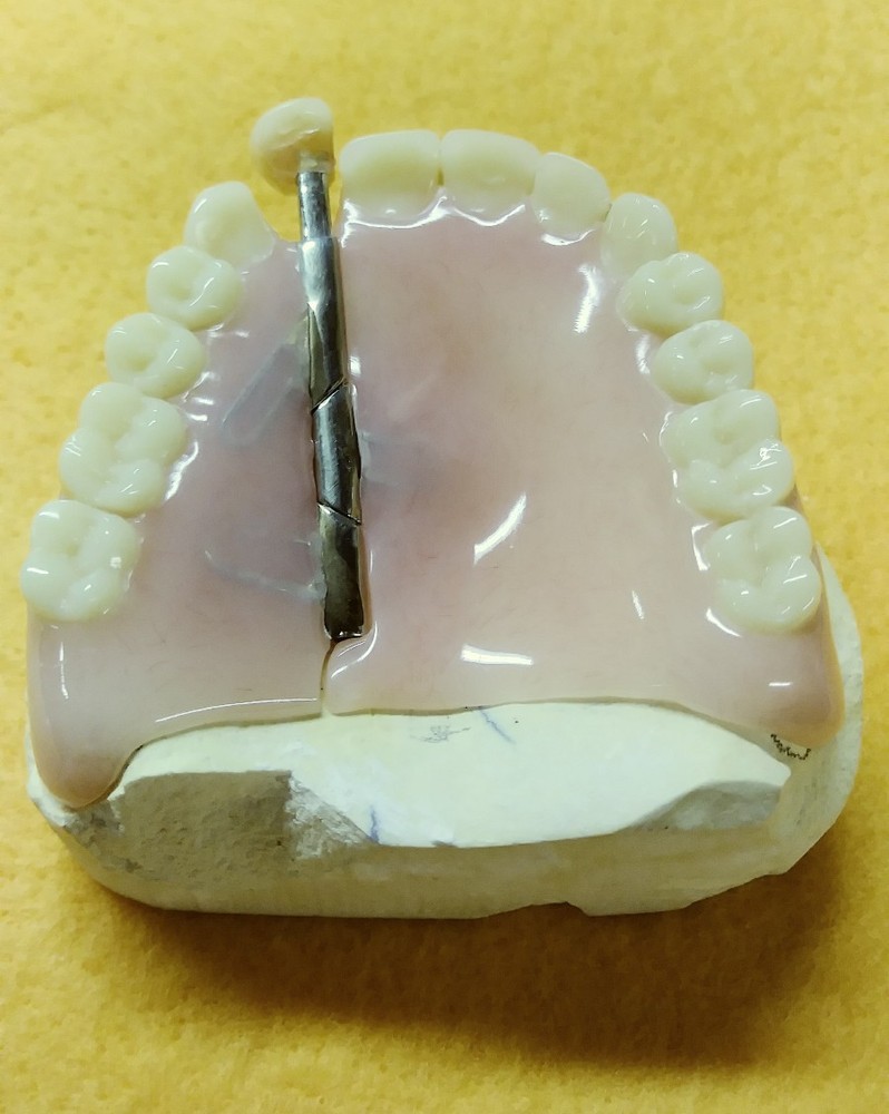 Devided Denture DENTAL DEMONSTRATION TEACHING MODEL Lab Dentist & Oral Surgeon