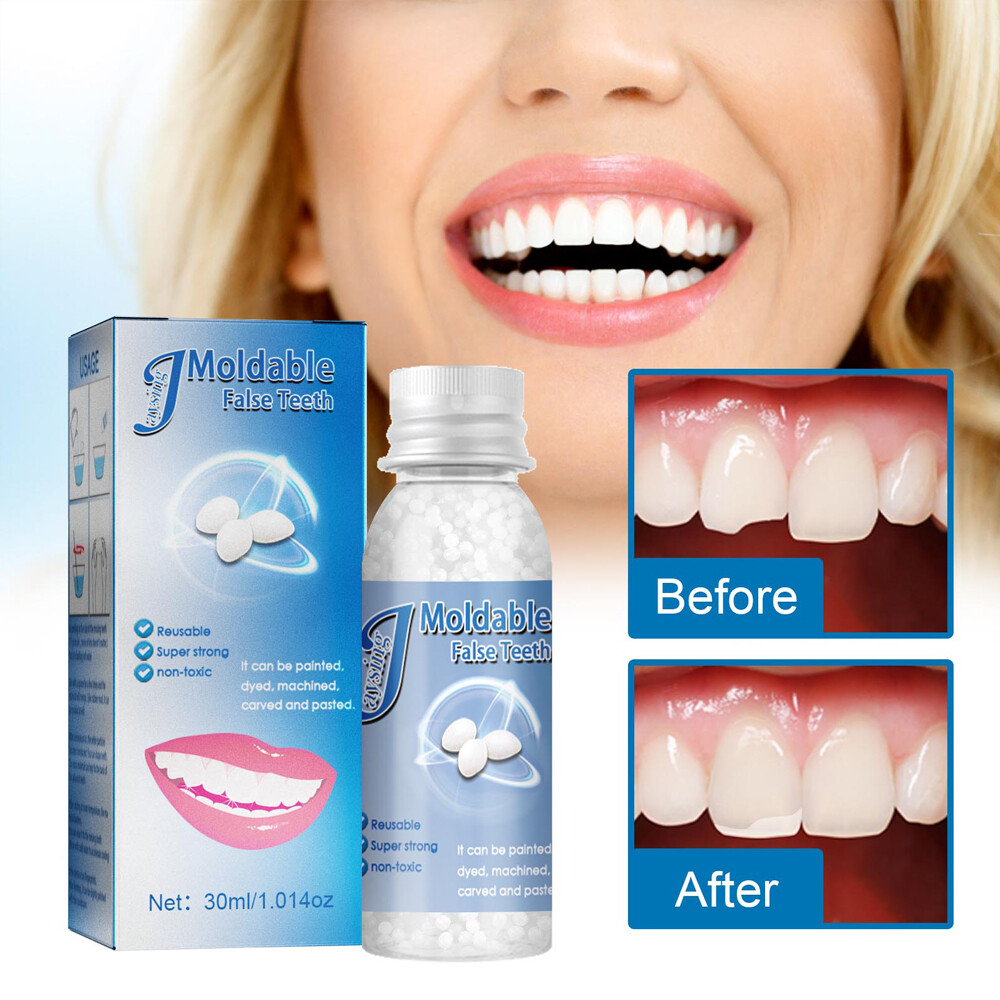 Resin False Teeth Solid Glue Temporary Tooth Repair Set Teeth And Gap Adhesive