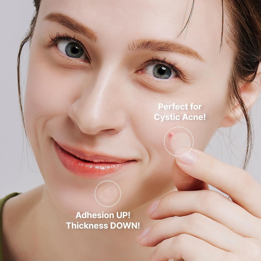 Acropass Acne Cure DEN Microarray Patch 4 Pack | Microneedle Acne Treatment