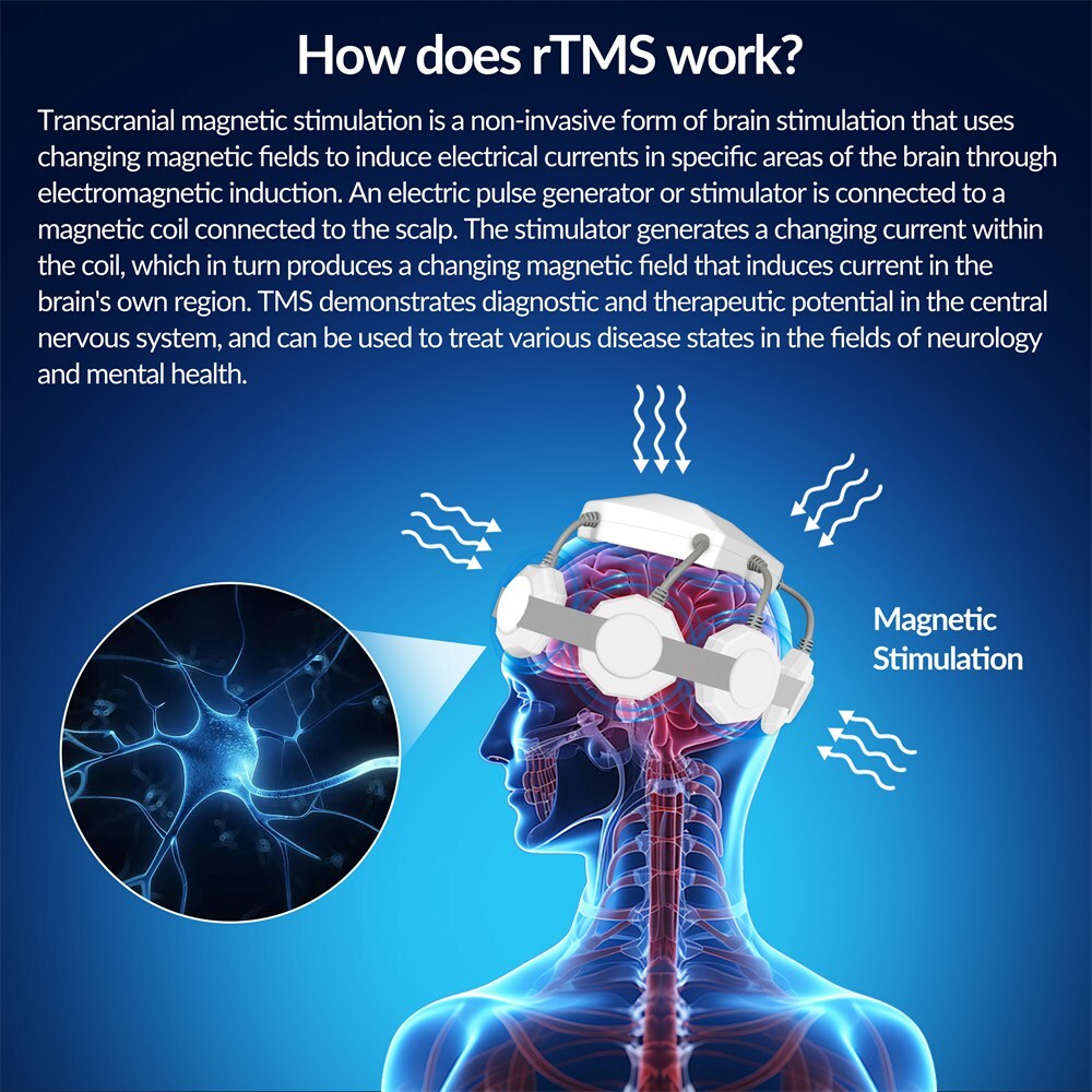 rTMS Stimulation Brain Circulation Improver Enhances Memory & Attention Safe