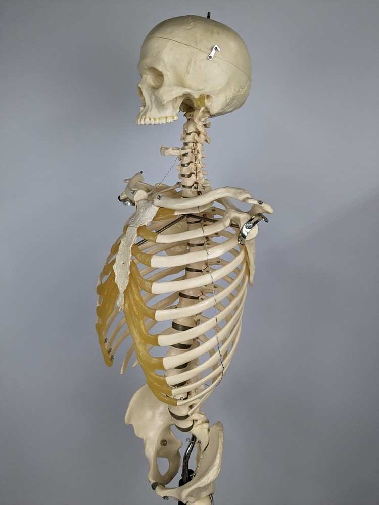 Somso Human Skeleton Anatomical Model with Rolling Stand Base