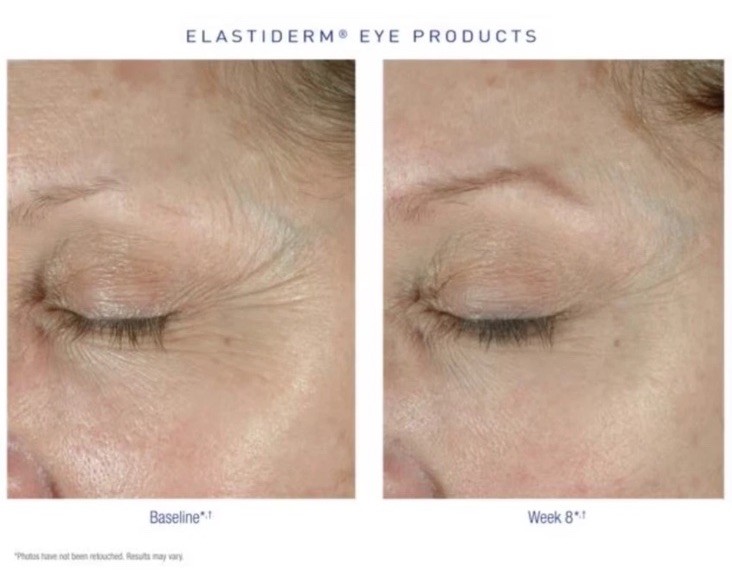 Obagi ELASTIderm Eye Cream 0.5 oz Eye Cream
