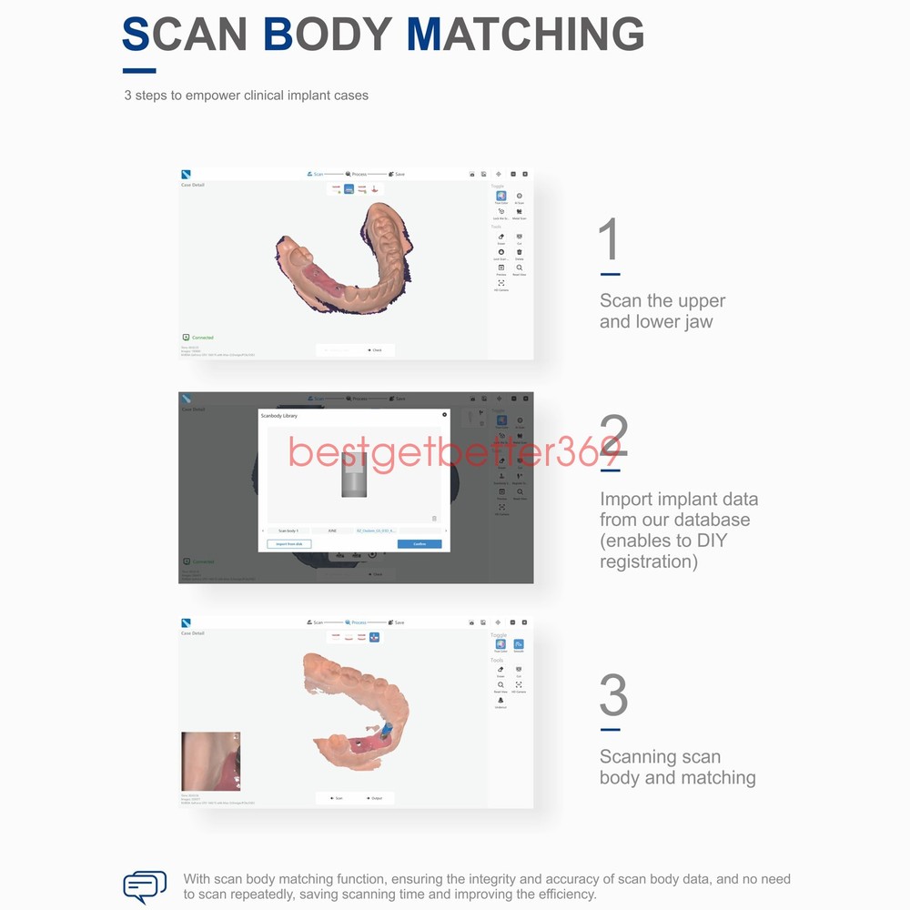Dental Digital Impression Intraoral 3D Scanner Scanning Software CAD/CAM Process