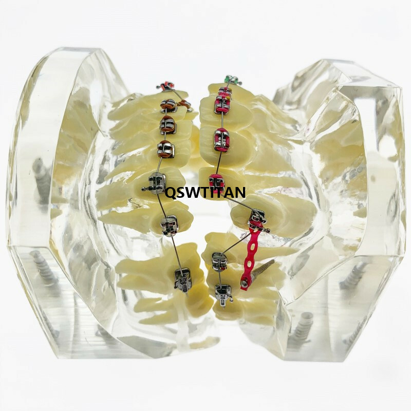 Dental Orthodontic Model Teaching teeth model For Teaching demonstrating model