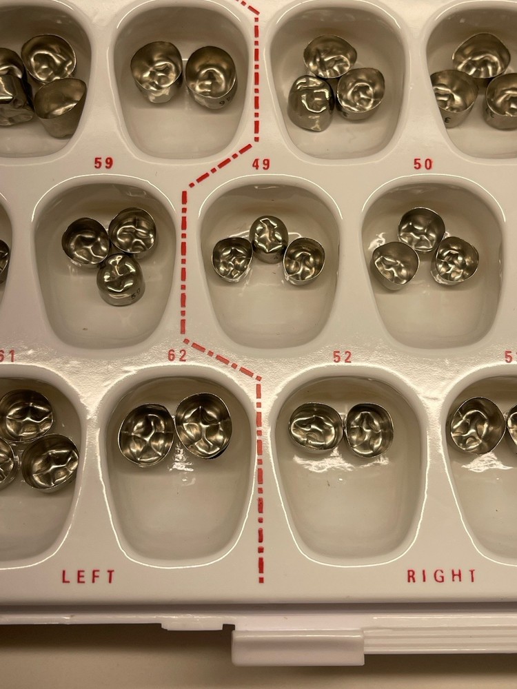 Second Primary Molar Crowns by Rugby Labs
