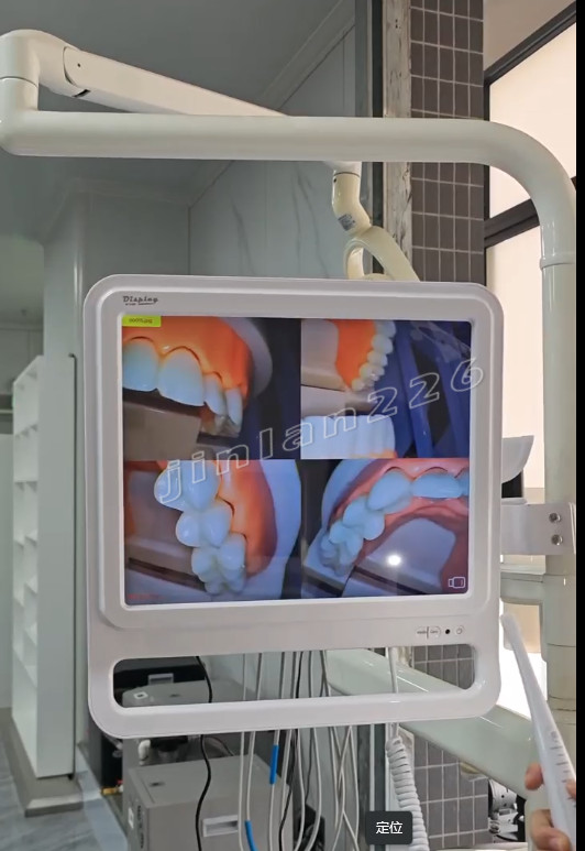 Wifi Conntction Function Dental Intra Oral Camera