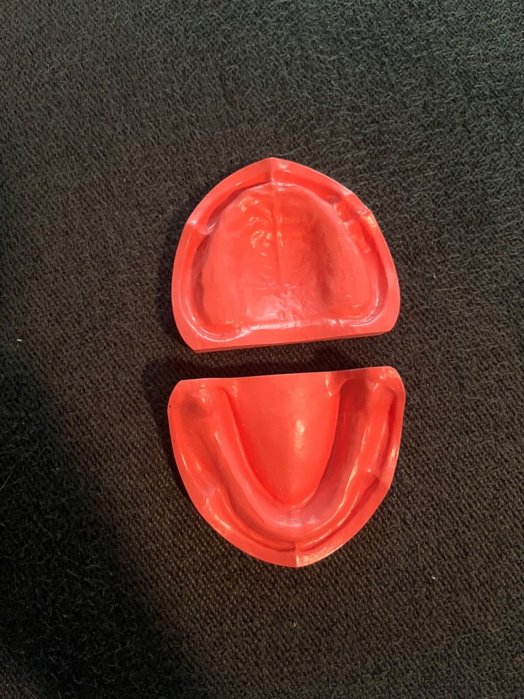 Acadental edentulous ridges (ModuPRO refill kit)