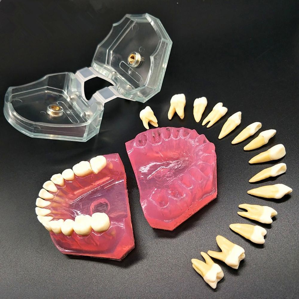 Dental Orthodontic Typodont Plastic Teeth Model 4004 Removable Teeth Standard
