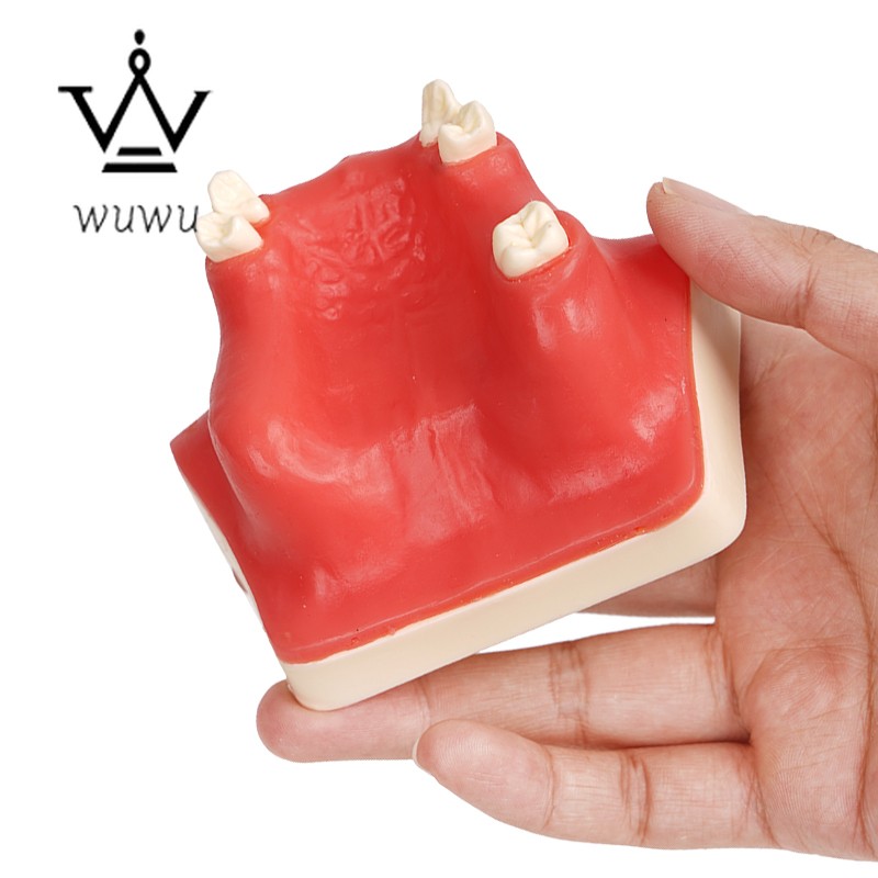 Dental Implant Teaching Model Upper Jaw Maxillary Sinus Model