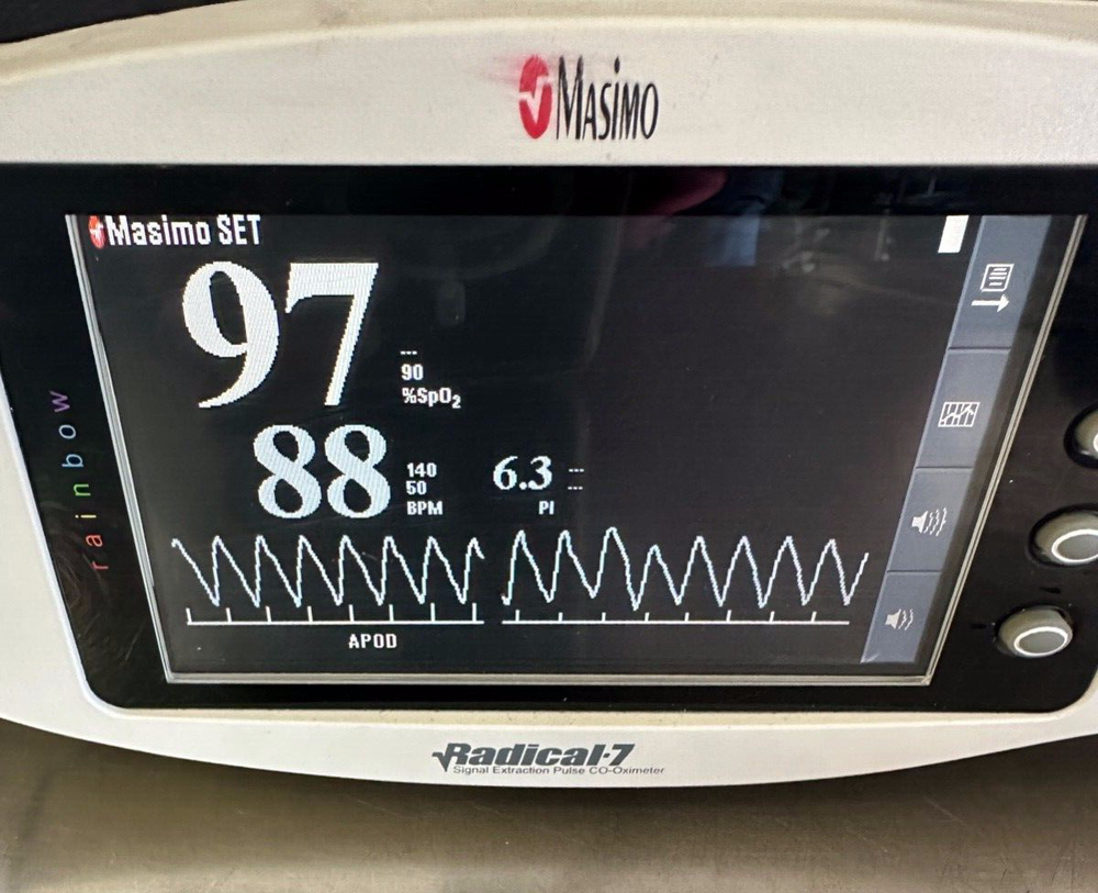 Masimo Radical 7 Rainbow