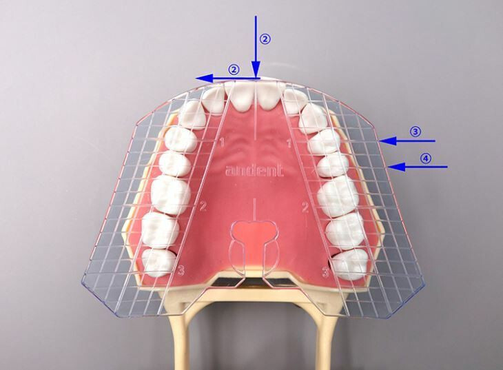 1 Pcs Dental False Teeth Arrangement Guide Template Plate Complete Denture