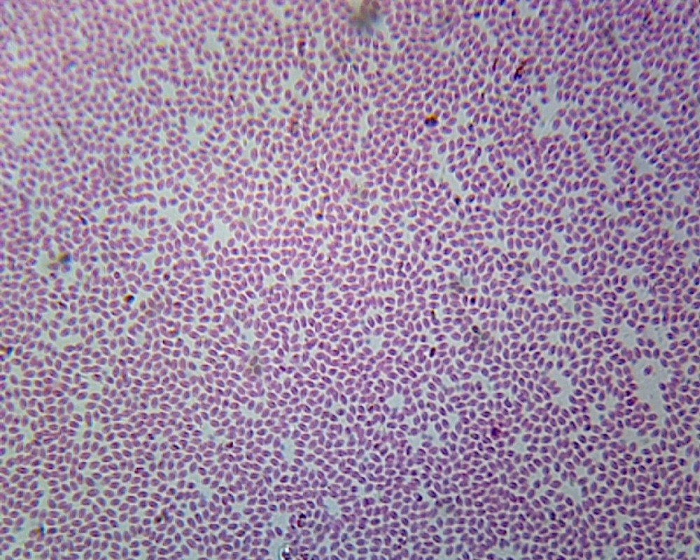 Earthworm Blood; Smear
