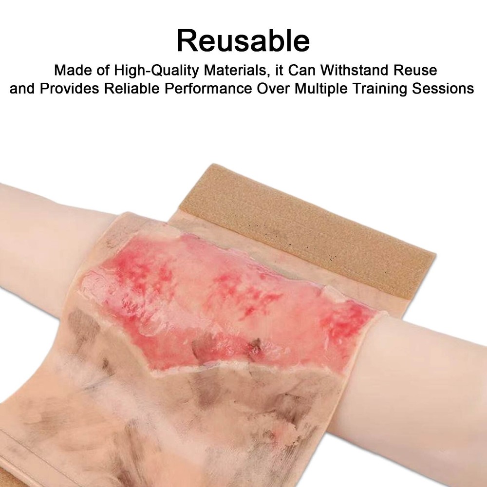 Limbs Burn Model, with Realistic Wound Simulation Module,Medical First Aid Train