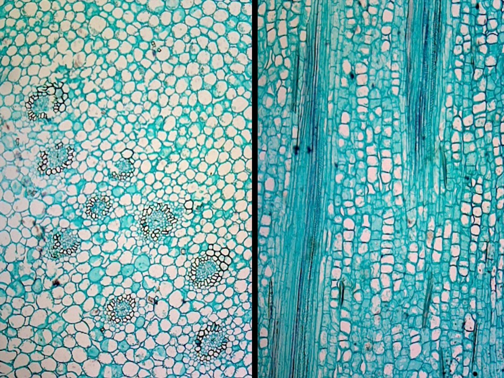 Iris Stem; Typical Monocot Stem; Cross Section and Longitudinal Section