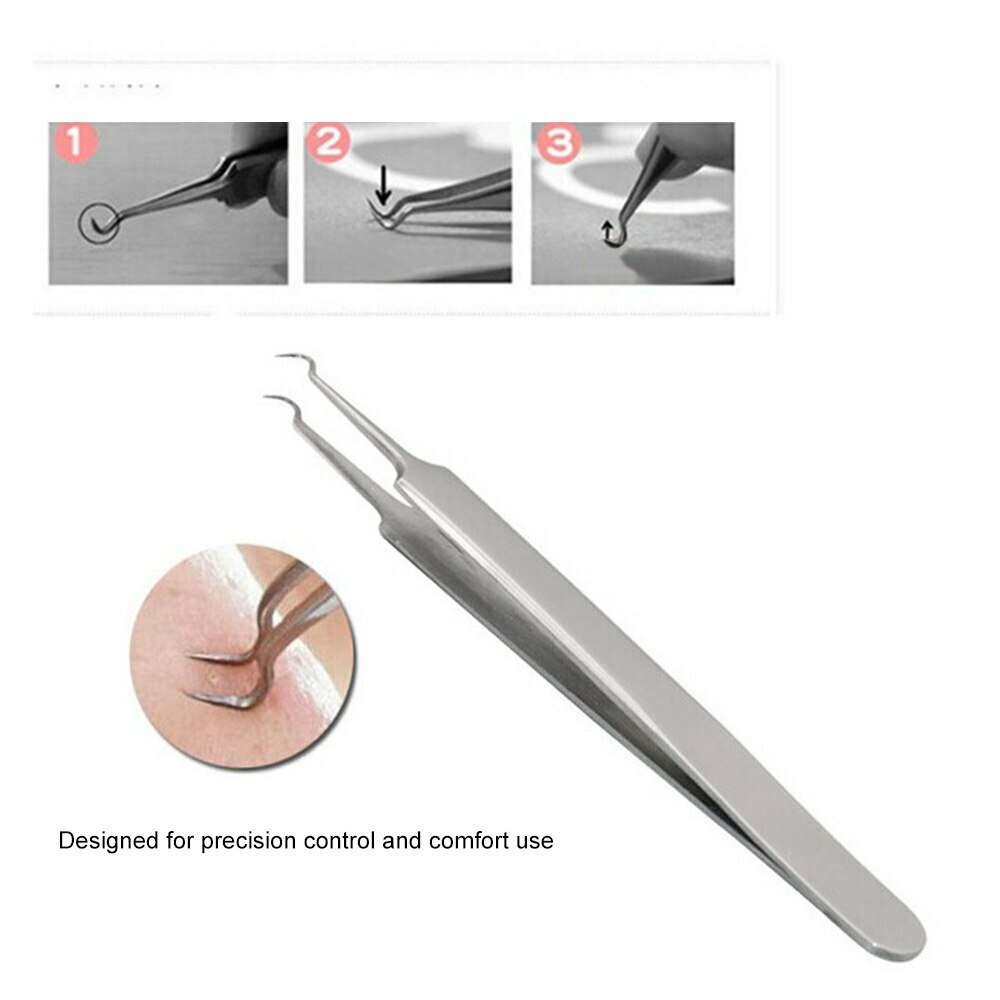Blackhead/Whitehead Cleaner Acne Remover Comedone Extractor Tool kit SC-1109