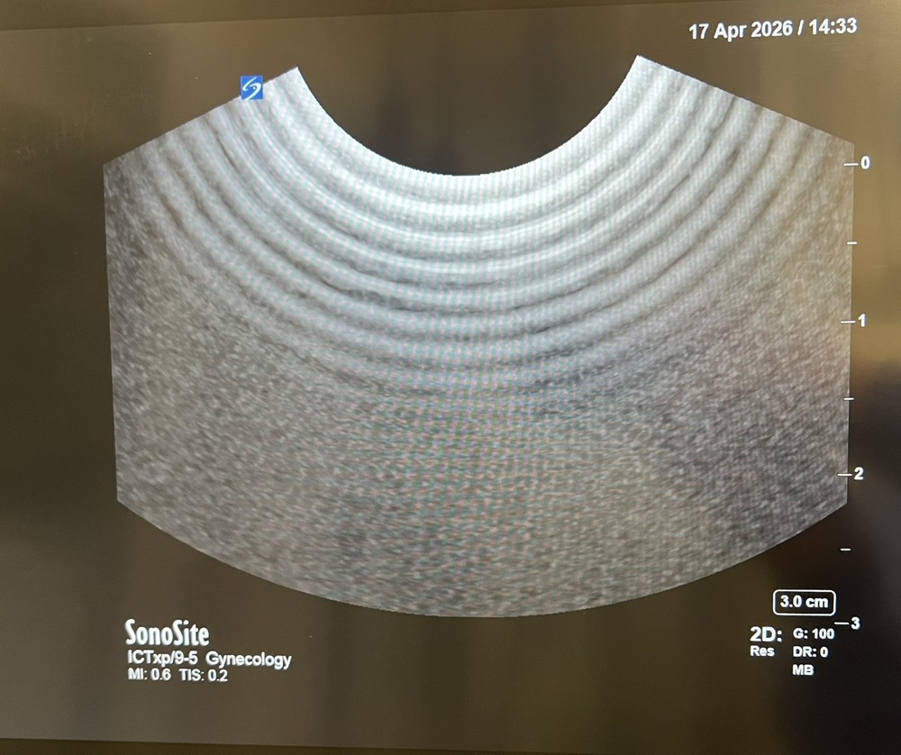 Sonosite ICTxp/9-5 Transducer Ref P14562-20