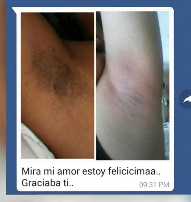 Cremas Blanqueadora Doña Iris