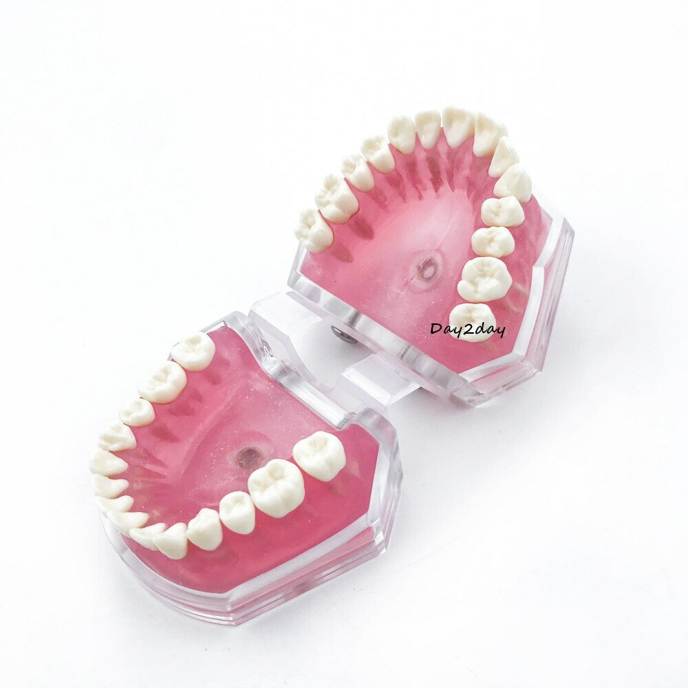 Teeth Model Dental Standard Model with Removable Teeth Dental Study Model