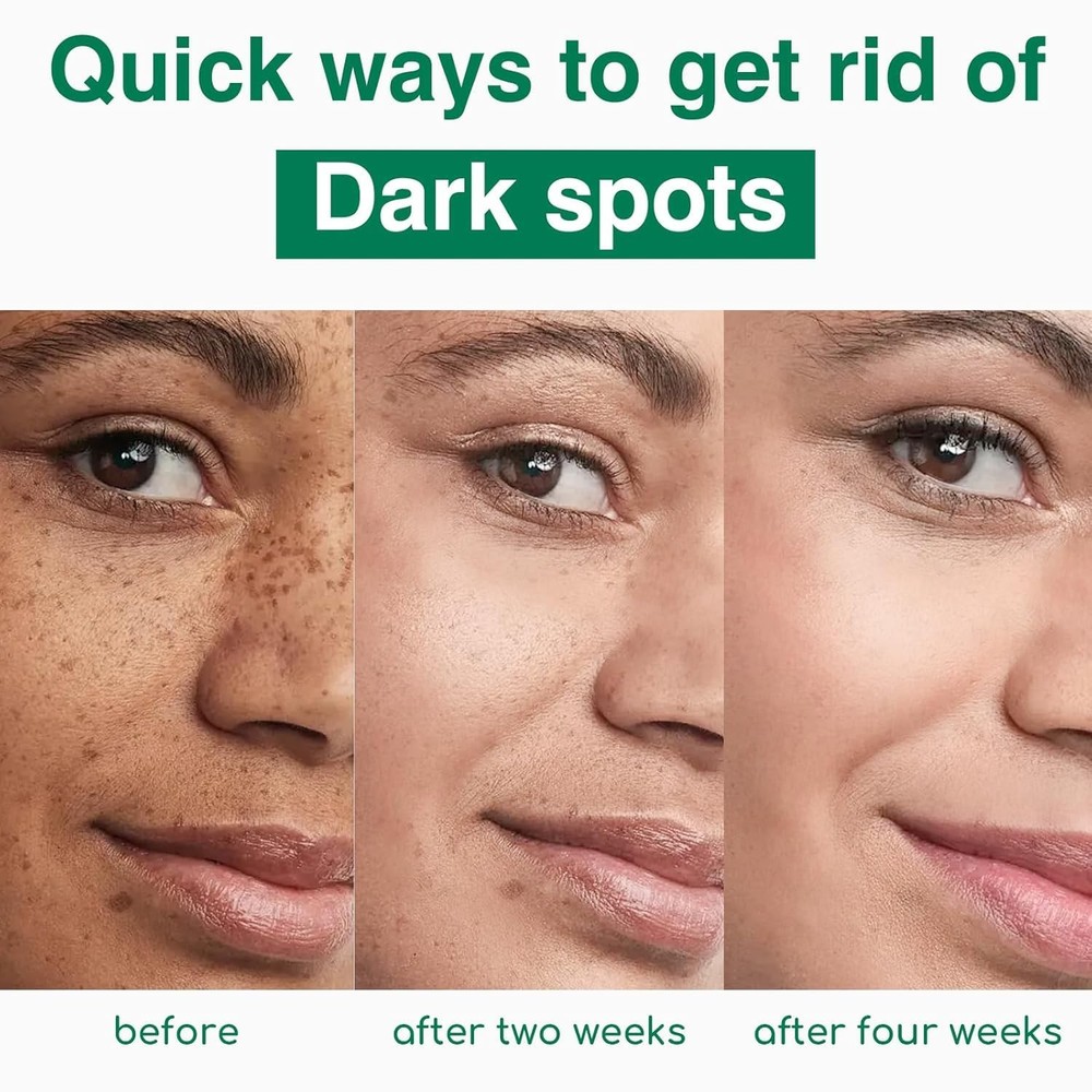 Dark Spots Corrector Cream, 45% Active Concentrate with Vitamin C, B5, E, 50ml