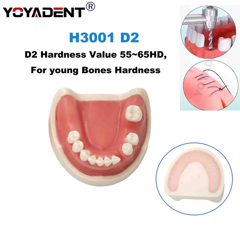 Dental Teeth Implant Practice Model For Dentistry Teaching Study Soft Gums