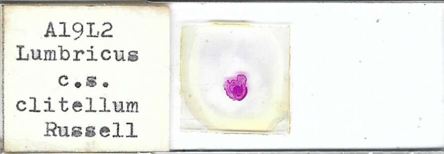 Earthworm Lumbricus c.s. Clitellum  Microscope Slide