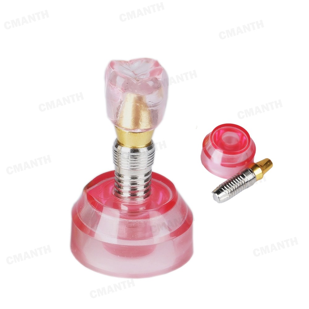 Dental Implant Model Demonstration Teeth Study Teach Model Detachable M2020