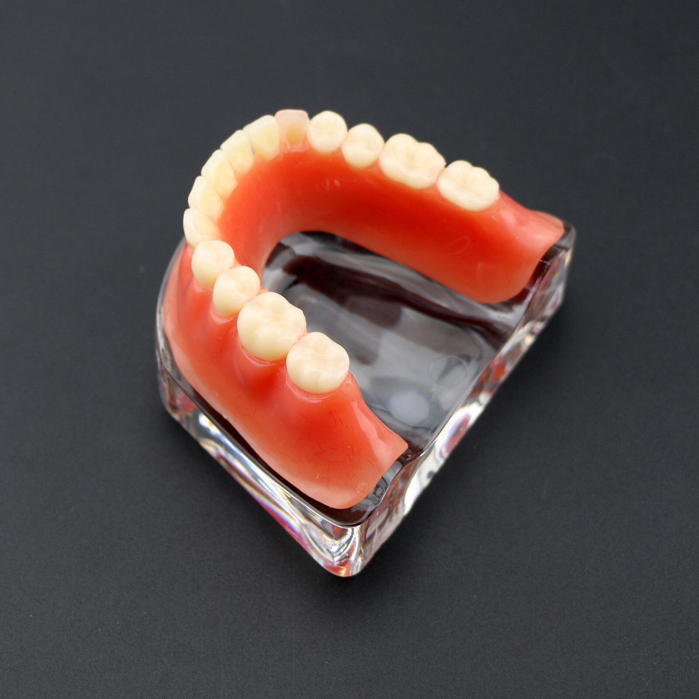 Dental Inferior Overdenture Model Lower Precision Implants With Silver Bar #6009