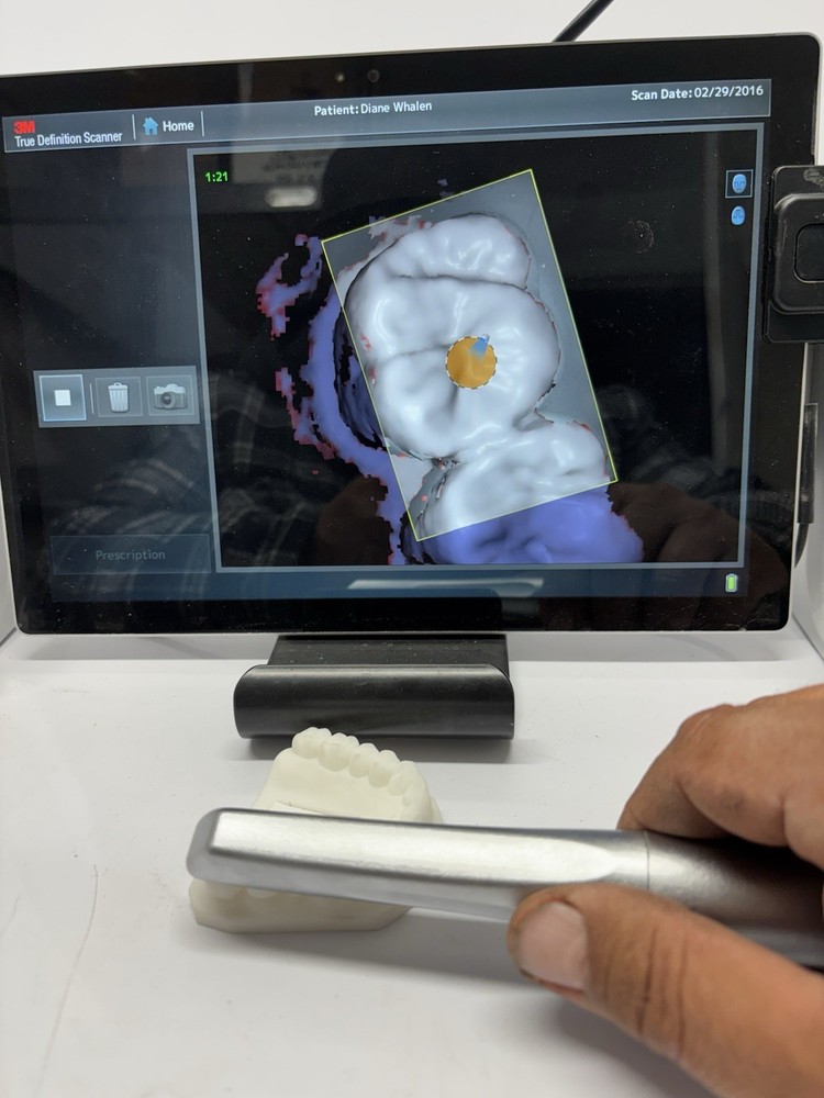 3M TRUE DEFINITION INTRAORAL SCANNER