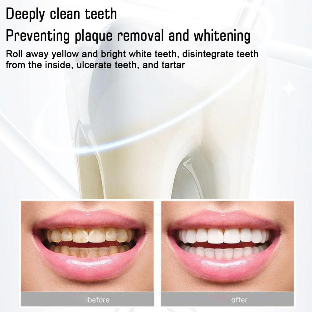 2PCS SP-6 Probiotic Toothpaste,Sp-6 Toothpaste Whitening Quick White Toothpaste