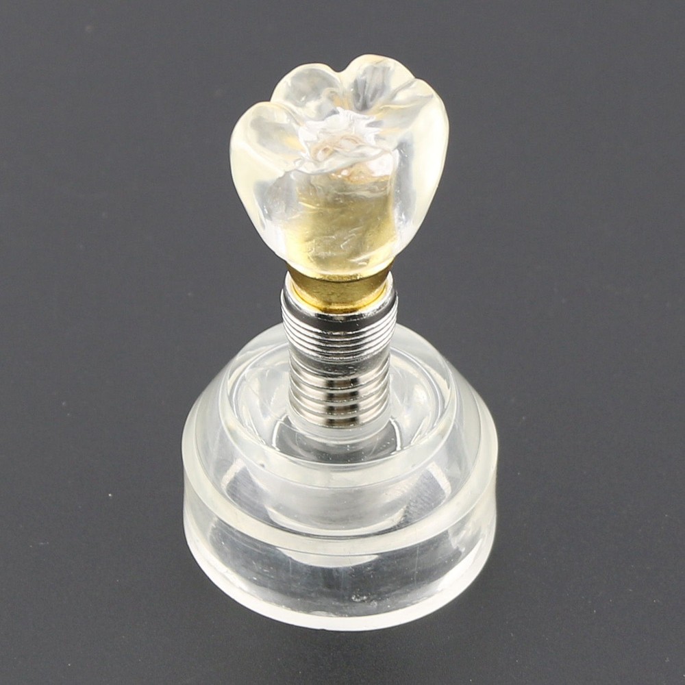 Dental Implant Model Demonstration Teeth Study Teach Detachable Crown Bridge